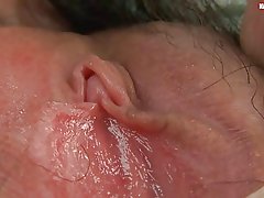 Τριχωτό σόλο Ασίας συμβαλλόμενα και υγρό